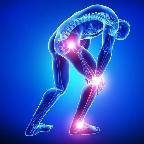 castle-chiro-sciatica-treatment-chepstow